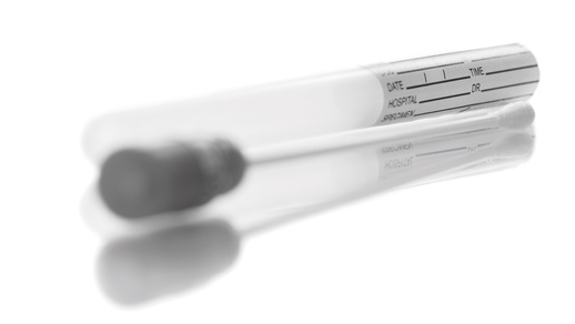 Speichelprobe für DNA-Test © Shutterstock