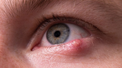 Gerstenkorn © iStock