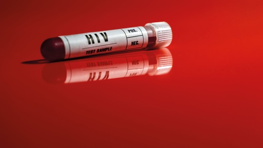 HIV-Test © iStock