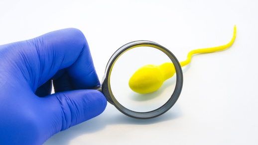 Symbolbild Spermien © Shutterstock