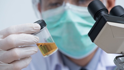 Hyponatriämie ist mehr als eine harmlose Laboranomalie. Sie kann zu schweren Komplikationen führen. © Shutterstock