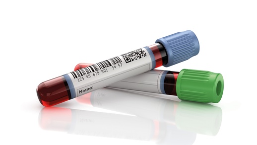Blutproben © Shutterstock