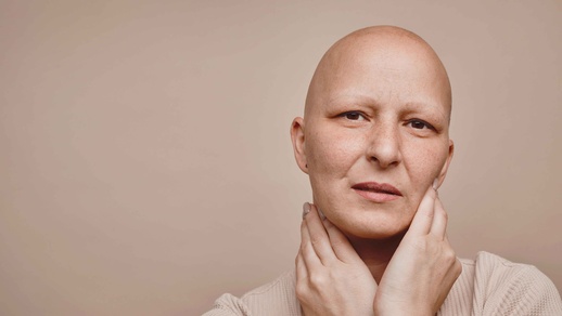 Frau mit Glatze © iStock