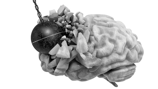 Symbolbild Migräne © Shutterstock