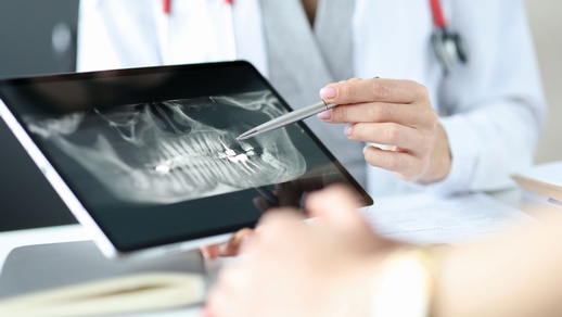 Gingivitis © Shutterstock