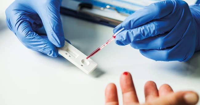 Antikörpertests © Shutterstock