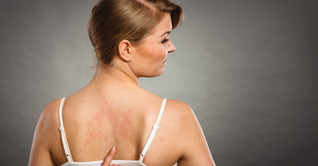 Haut © Shutterstock