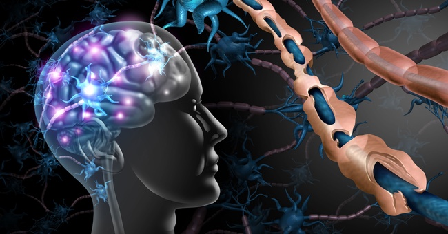 Symbolbild Multiple Sklerose © Shutterstock