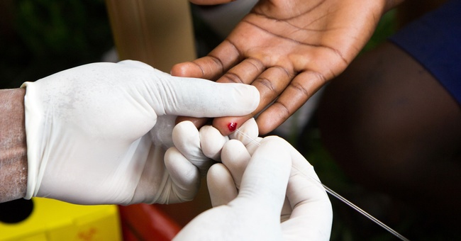 HIV-Test © Shutterstock
