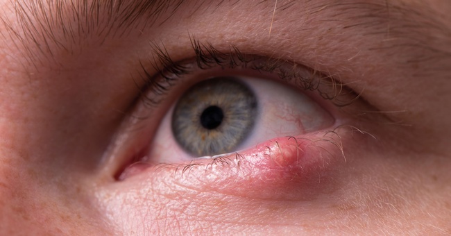 Gerstenkorn © iStock