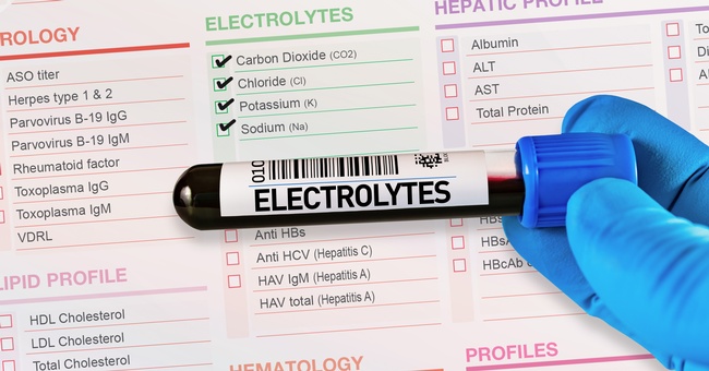 Symbolbild einer Blutprobe auf der das Wort "Elektrolyte" steht. © Shutterstock