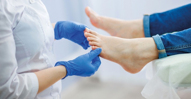Bei Nagelpilzinfektionen kommt es in der Regel zu keiner Spontanheilung, weshalb sie immer therapiert werden müssen. © Shutterstock