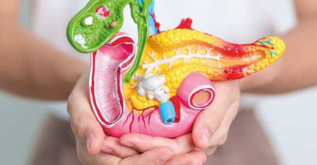 Die Ursachen für eine unzureichende Produktion von Verdauungsenzymen durch die Bauchspeicheldrüse reichen von Entzündungen über Stoffwechselstörungen bis hin zu Tumoren. © Shutterstock