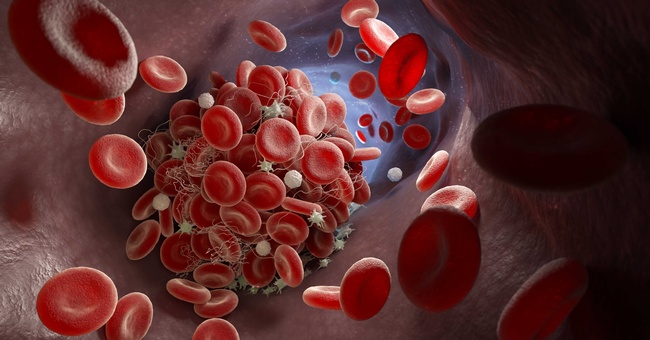 Symbolbild Blutgerinnung © Shutterstock