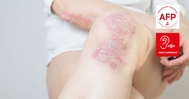 AFP_Audio170226 &copy; Shutterstock/APOVERLAG