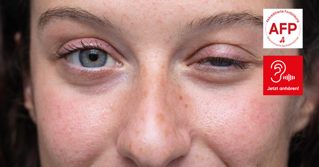 Imavy1614 &copy; Shutterstock