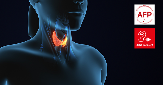 Tapazza &copy; Shutterstock/APOVERLAG