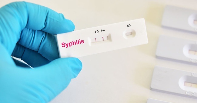 Syphilis © shutterstock