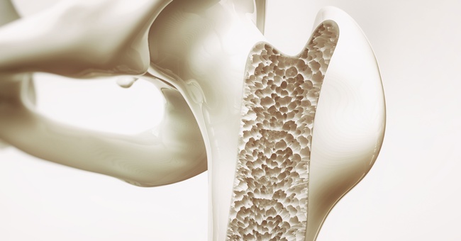 Osteoporose © Shutterstock