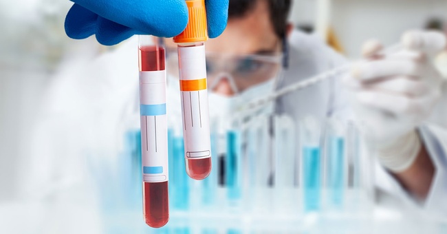 Cholesterinwerte messen © shutterstock