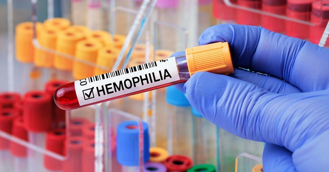Hämophilie B © shutterstock