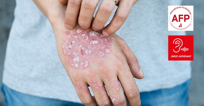 NEUEWIRKSTOFFE © Shutterstock/APOVERLAG