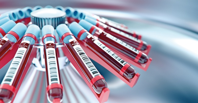 Blutampullen © AdobeStock