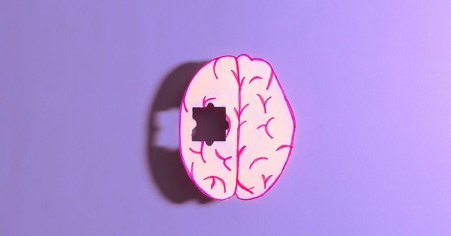 Demenz dargestellt als fehlendes Puzzlesteil des menschlichen Gehirns © Shutterstock