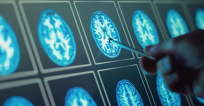 KI unterstützt bei OPs © Shutterstock