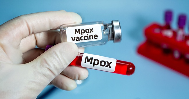 MPOX © Shutterstock