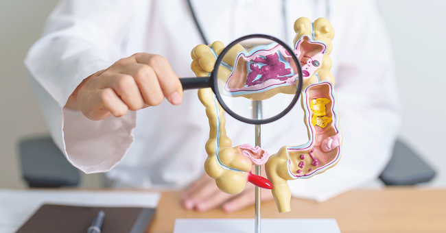 Neue Daten zeigen, dass Metformin seine zentrale Stoffwechselwirkung  direkt im intestinalen Epithel entfaltet. &copy;  iStockphoto