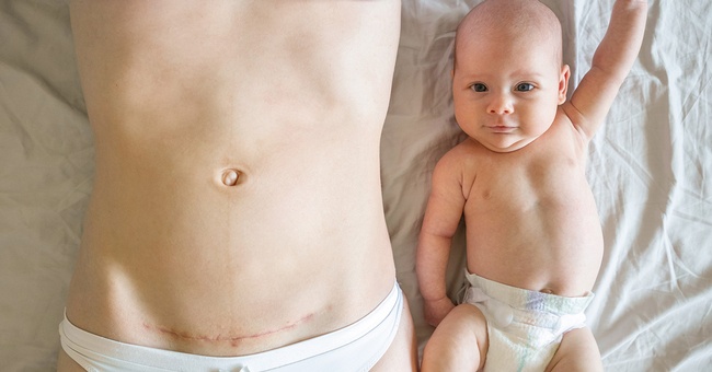 Schnitt © Adobestock