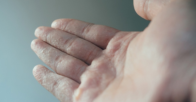 Hand © iStock