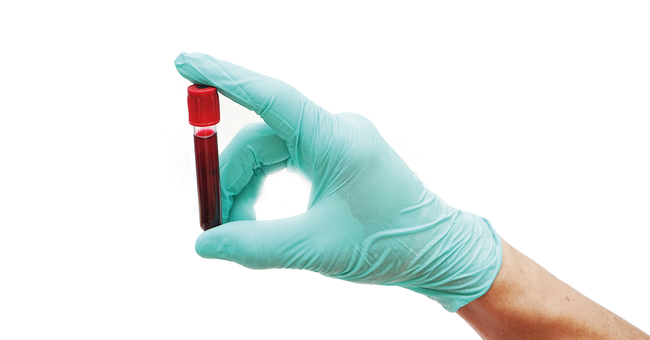 Blutprobe © Shutterstock
