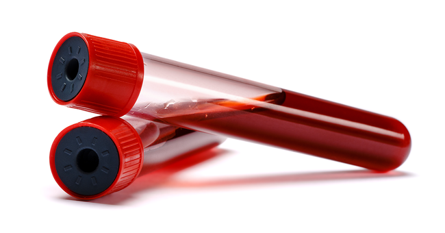 Blut im Reagenzglas © Shutterstock