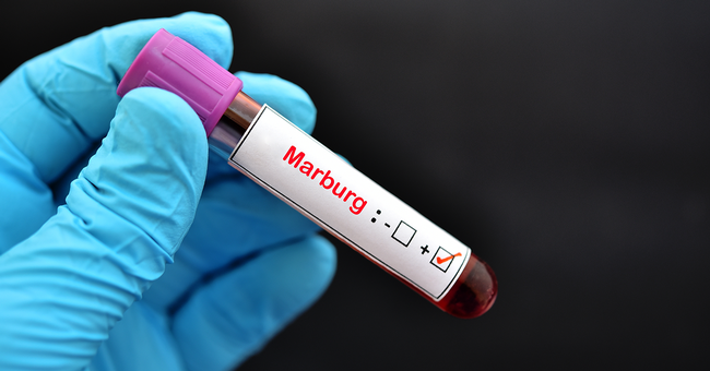 Marburg-Virus © Shutterstock