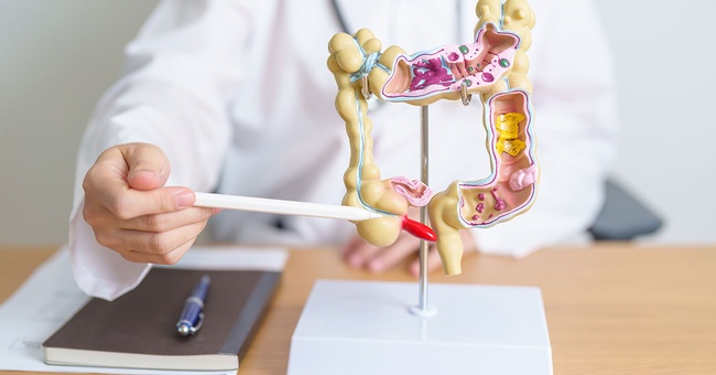 Darm © Shutterstock