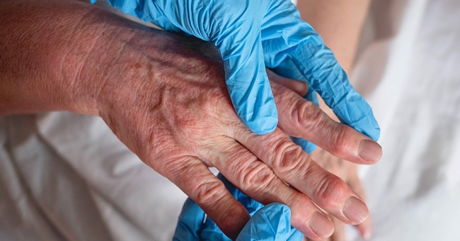 Für Rheumapatient:innen mit kardiovaskulären  Risikofaktoren gilt Naproxen als das günstigste NSAR. © Shutterstock