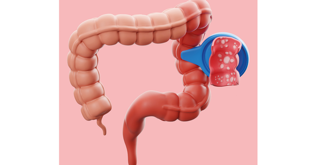 Darm &copy; Shutterstock