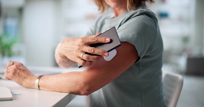 Display am Arm &copy; Shutterstock