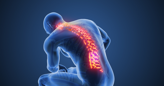 R&uuml;ckenschmerzen &copy; Shutterstock