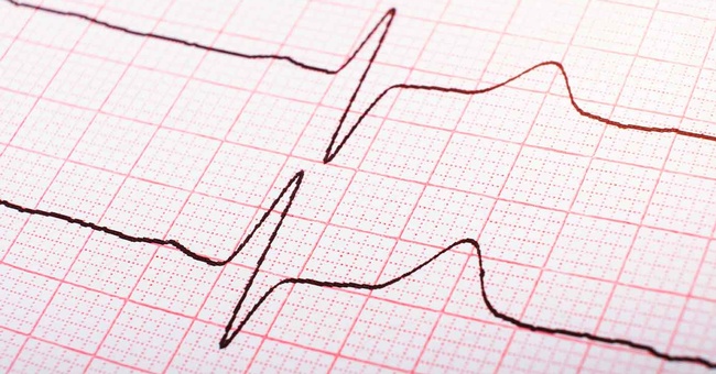 Hypertonie © Shutterstock