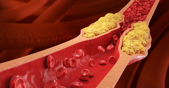 Cholesterinspiegel © shutterstock