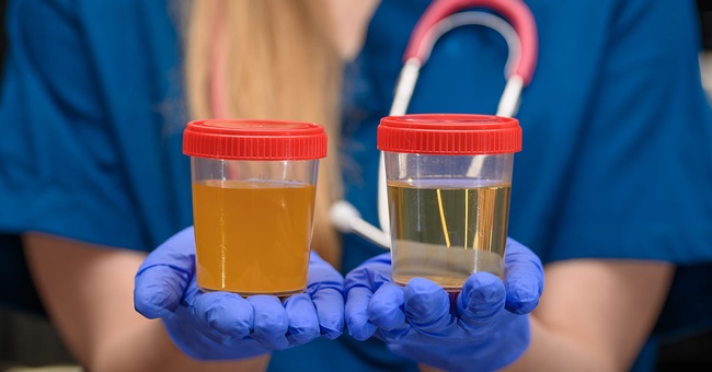 Urinprobe © shutterstock