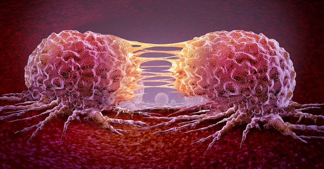 Metastasenbildung © shutterstock