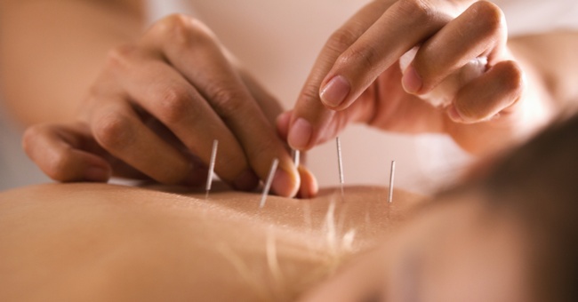 Laut WHO nutzen 80 % der Weltbevölkerung traditionelle Medizin, v. a. Akupunktur, Ayurvedische Medizin und pflanzliche Medizin. © Shutterstock