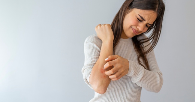 Eine Frau kratzt sich am Ellenbogen. © Shutterstock