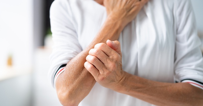 Symbolbild für Juckreiz. © Shutterstock