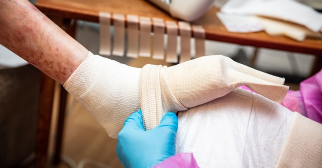 Das seltene Leiden Epidermolysis bullosa (EB) ist in der Öffentlichkeit besser aufgrund des Namens der betroffenen „Schmetterlingskinder“ als Schmetterlingskrankheit bekannt und beruht auf einer hereditär bedingten Hautbrüchigkeit. © Shutterstock