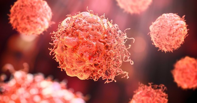 Krebszellen © Shutterstock